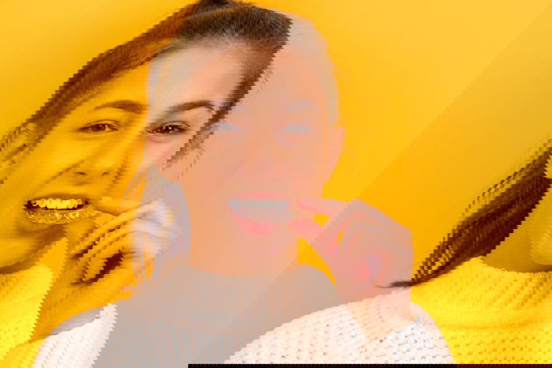 Photo Dental Invisalign Orthodontics