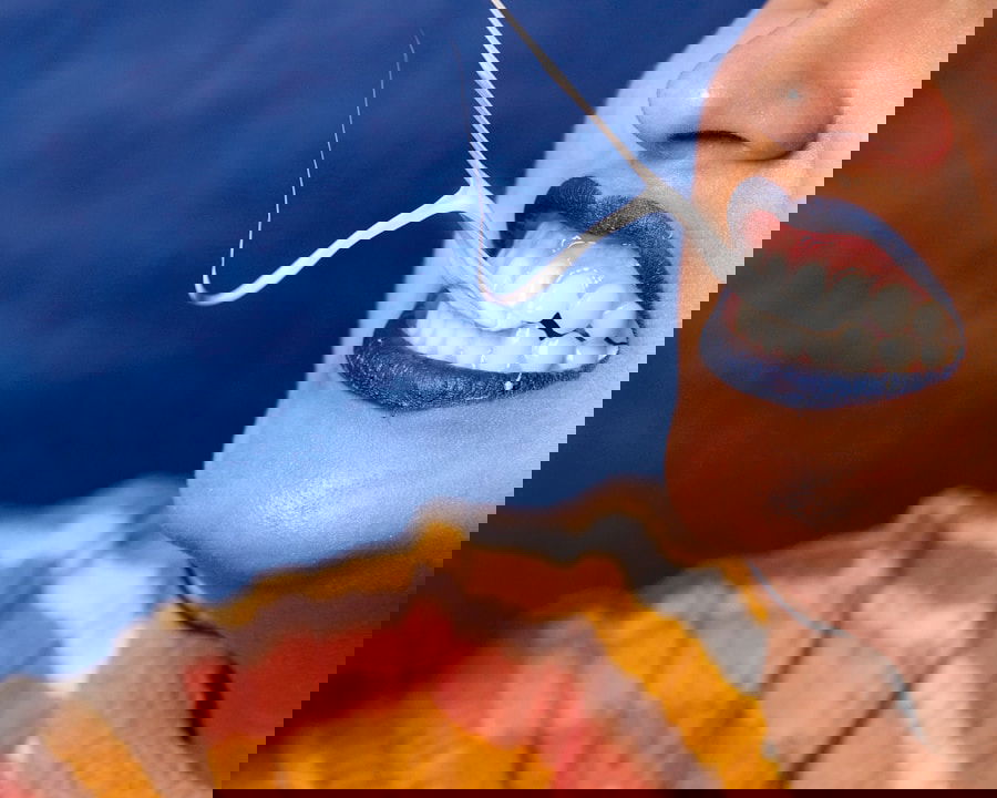 Photo Teeth Whitening