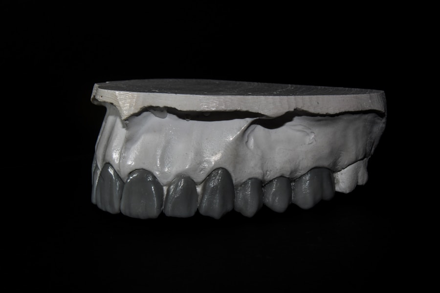 Photo Dental veneers before and after