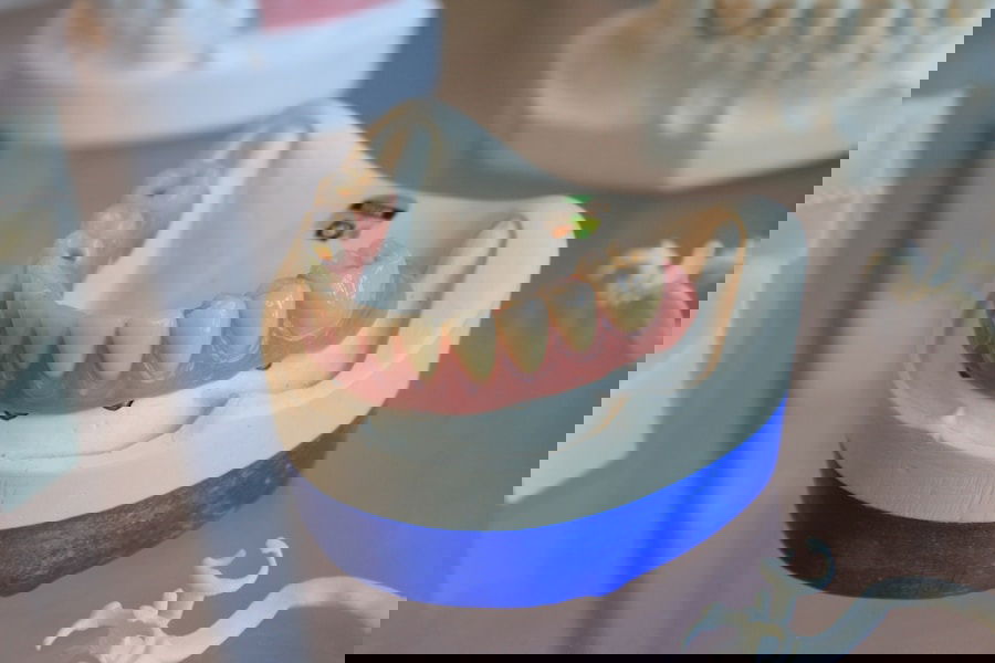 Photo Periodontal disease