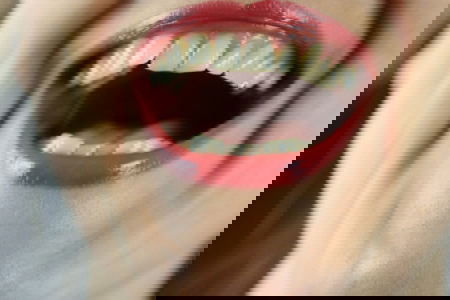 Photo "Are dental veneers permanent?"