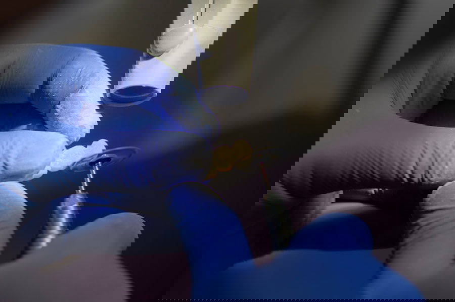 Photo Dental implant maintenance