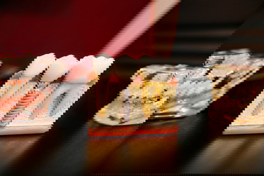 Photo Dental implant materials