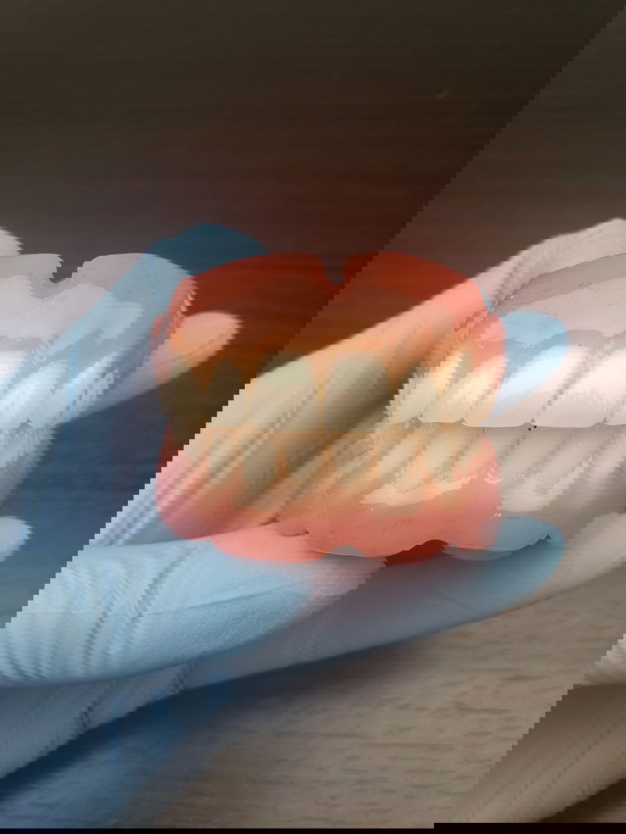 Photo Dental veneers for crooked teeth