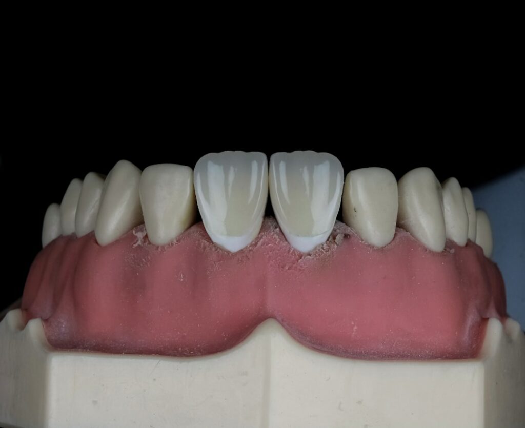 Photo Dental X-ray