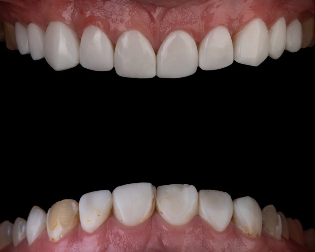 Photo Dental comparison