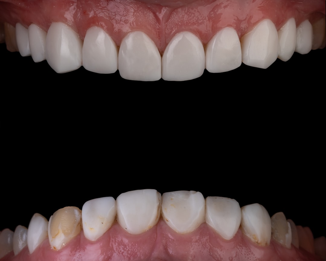Photo Dental comparison