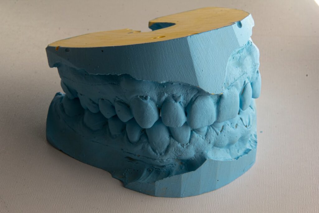 Photo Clear aligners