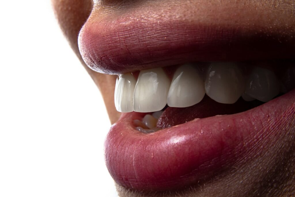 Photo teeth whitening reviews