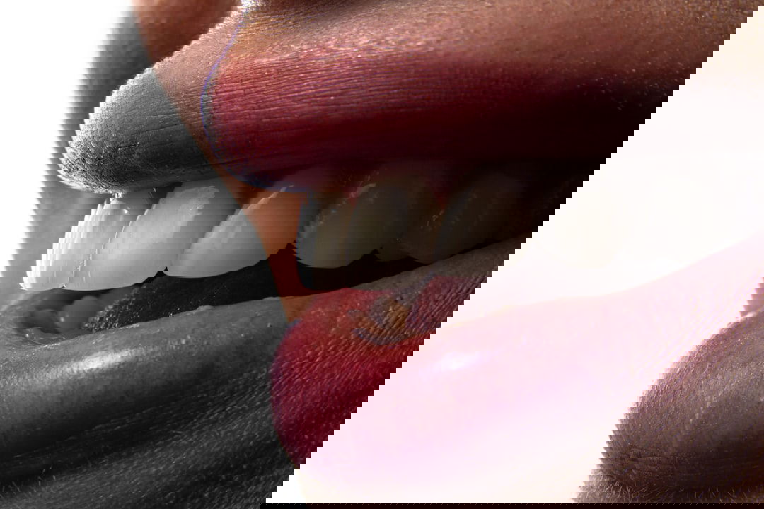 Photo teeth whitening reviews