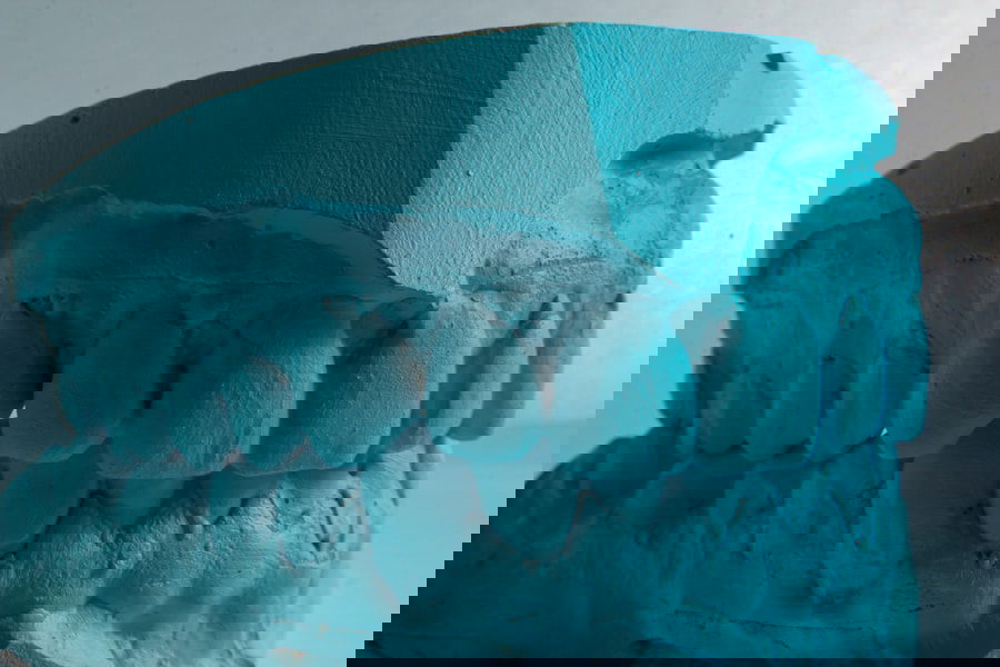 Photo clear aligners