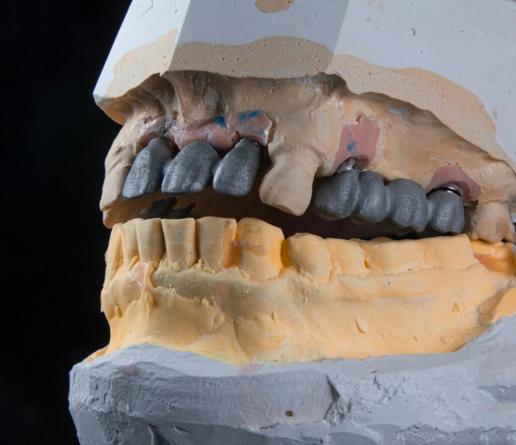 Photo Dentures