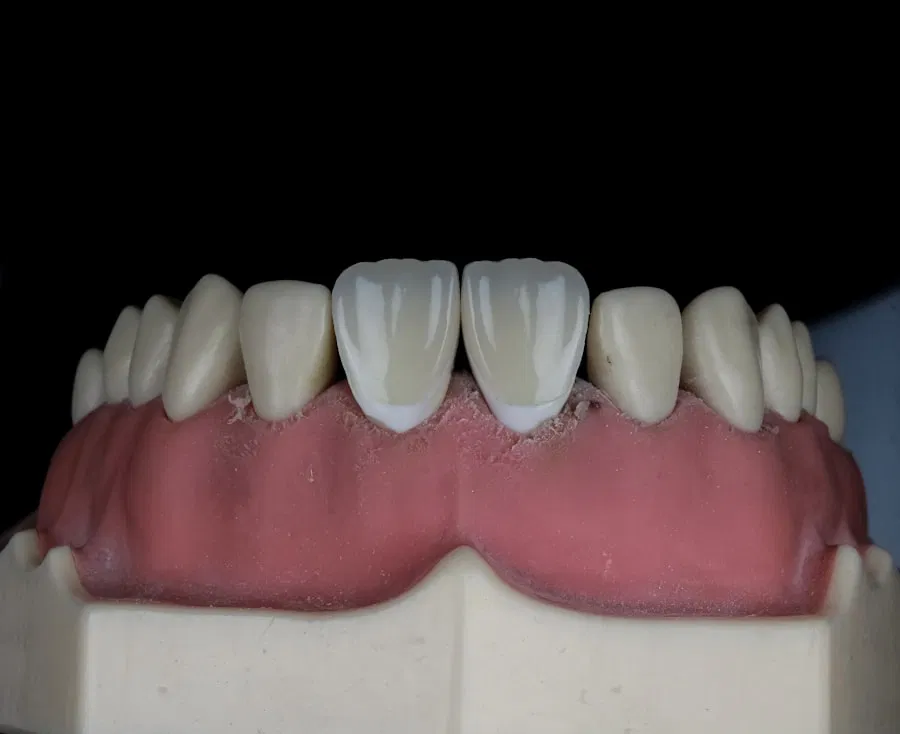 Photo Denture Adhesives