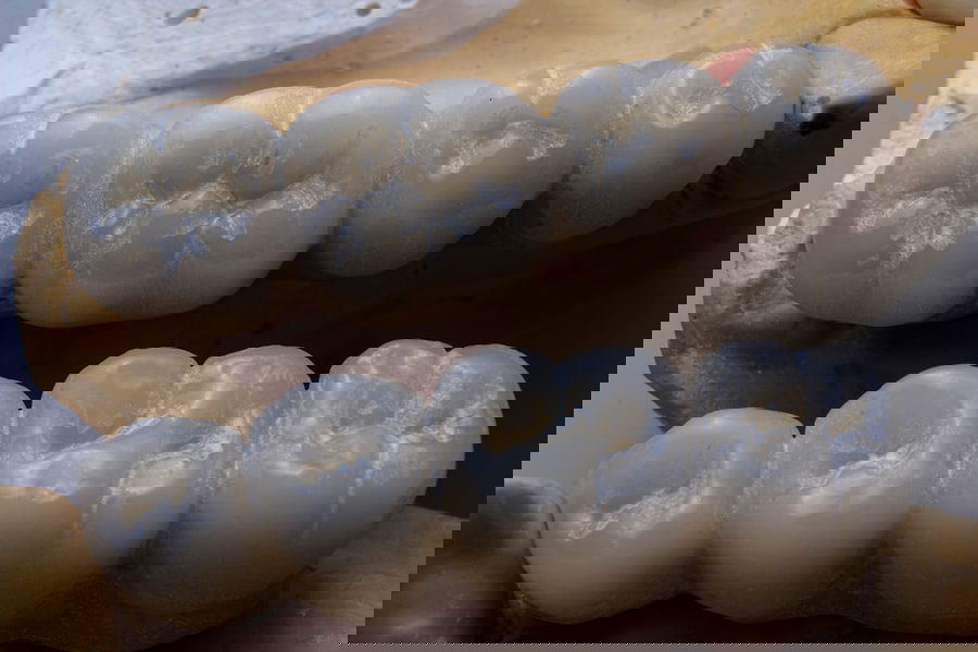 Photo Denture Alternatives