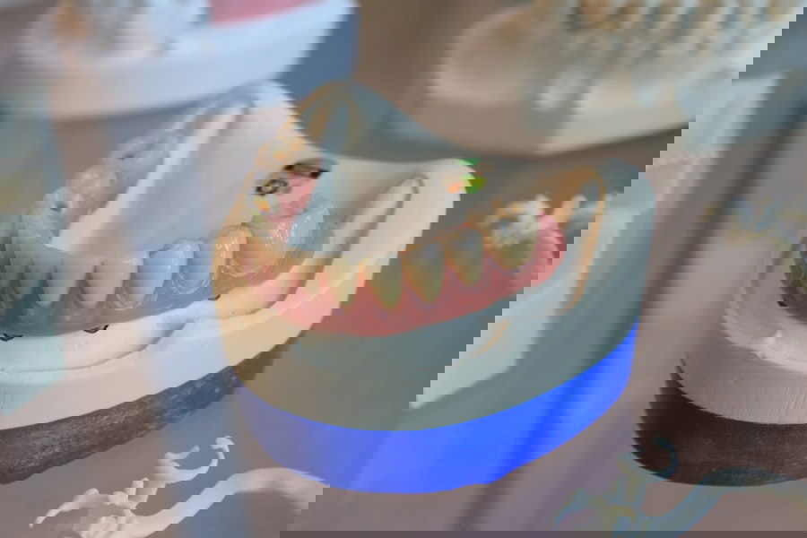 Photo Denture Problems